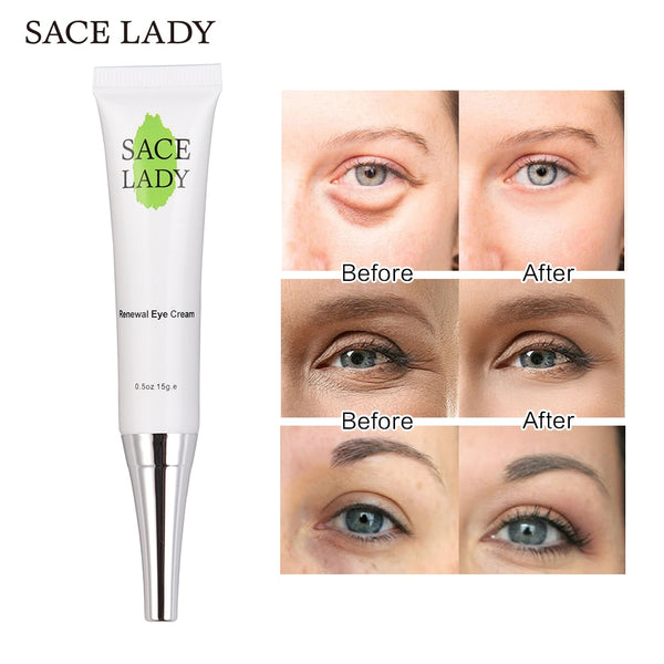 Eye Cream for Dark Circles Whitening Snail Cream Moisturizing Skin Care Eye